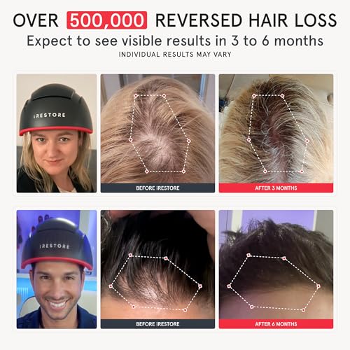Elite Laser Hair Growth System S678056