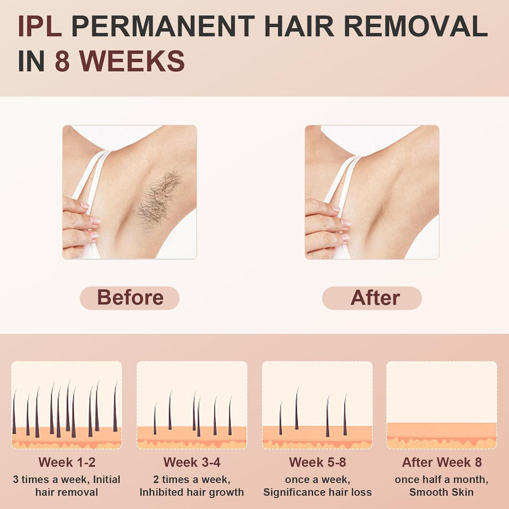 999900 Flashes IPL Hair Removal Device with Cooling System M660