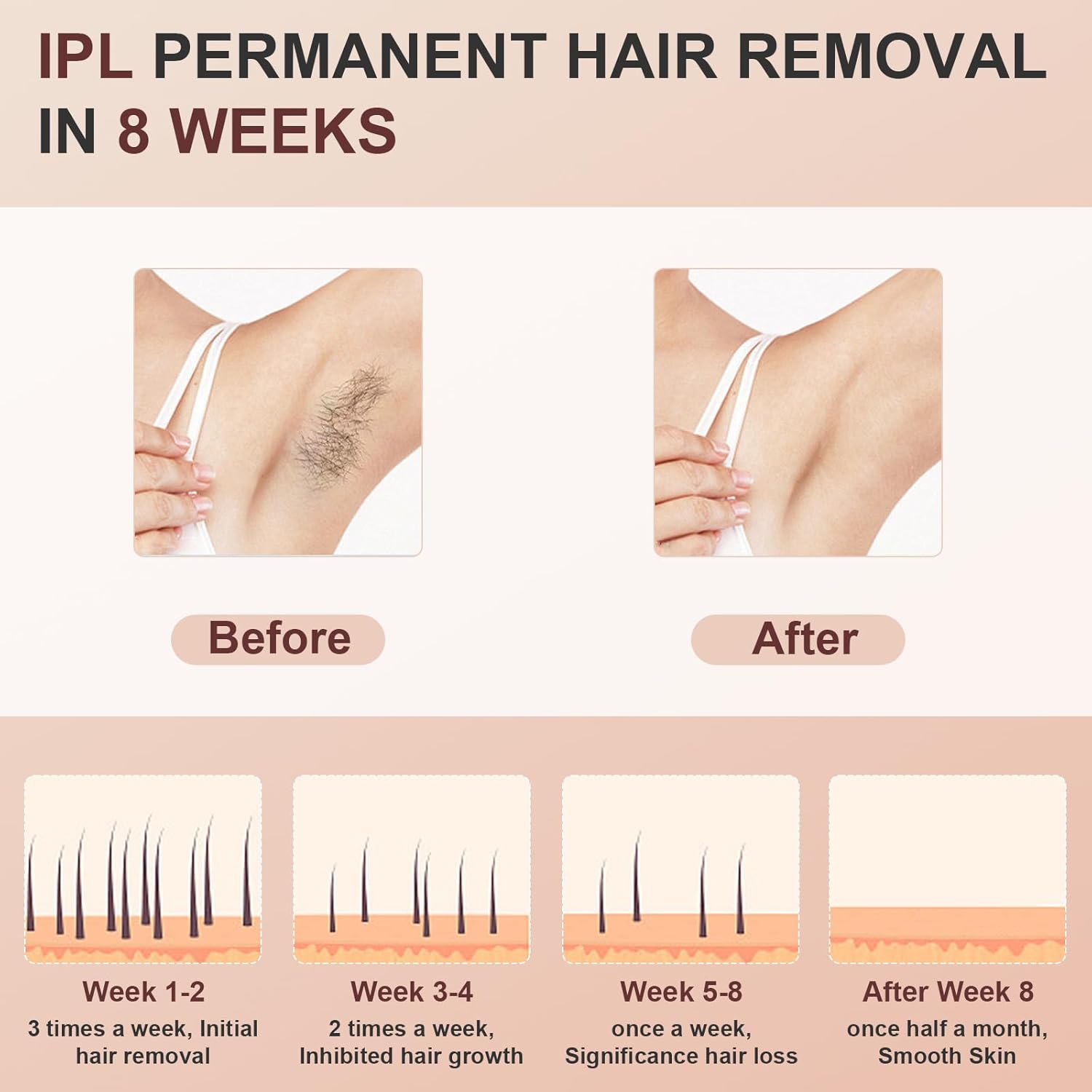 999900 Flashes IPL Hair Removal Device with Cooling System M660