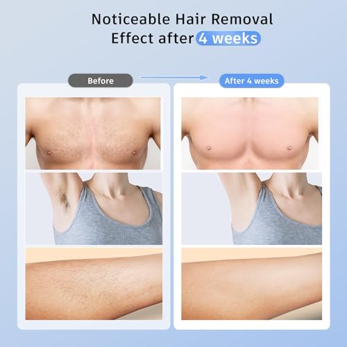 3 In 1 IPL Laser Hair Removal Device with Ice Cooling (Gold) S755